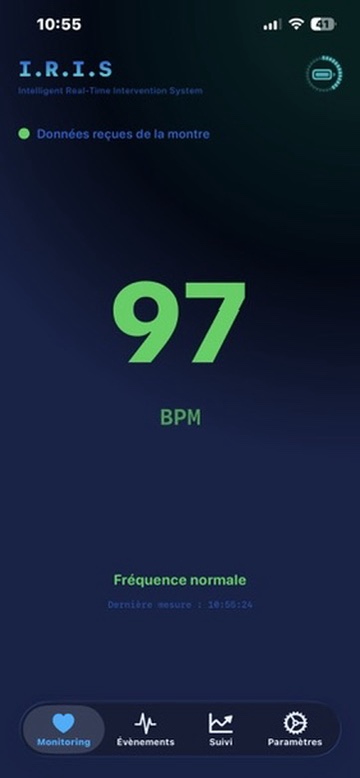 IRIS iPhone Screenshot