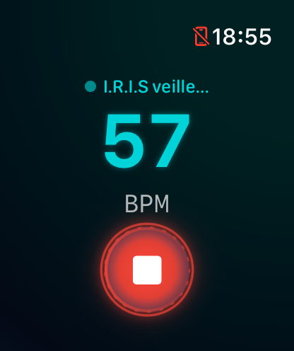 IRIS Apple Watch Screenshot
